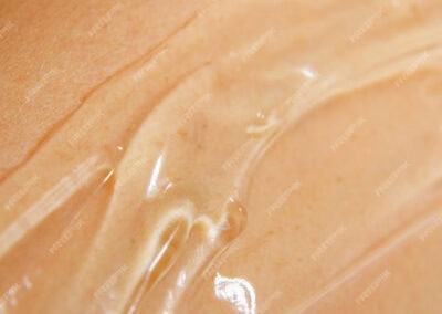 Gel silicium organique G5